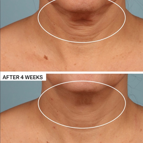COPY - StriVectin neck firming cream - Picture 8 of 8